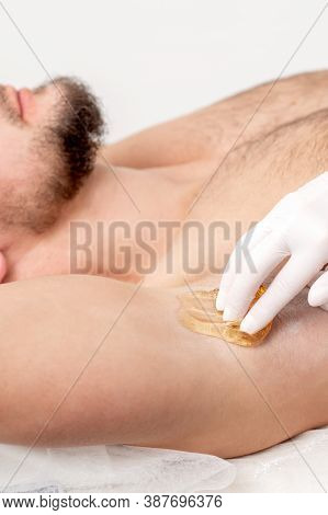 Depilation And Epilation Male Armpit With Liquid Sugar Paste. Hand Of Cosmetologist Applying Wax Pas