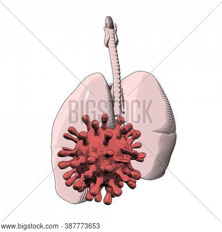 Illustration showing Coronavirus attacking human lungs. This virus could be dangerours or deadly SARS.
