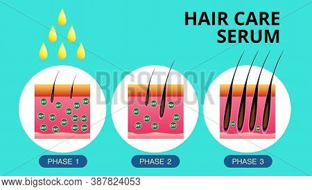 Hair Care Serum , Hair Transplantation, Vector Design