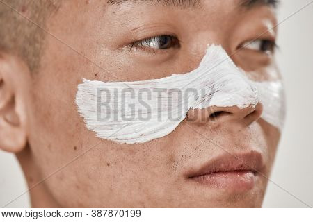 Close Up Of Face Of Young Asian Man With Problematic Skin And Hyperpigmentation Applied Mask On His 