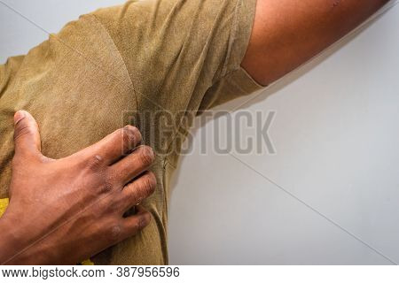 Itching Of Skin Diseases - Man Uses His Hand To Scratch The Armpit For Itch Skin. Not Something To D