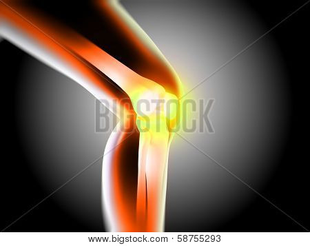 x ray of knee showing knee pain