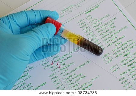 Transferrin testing