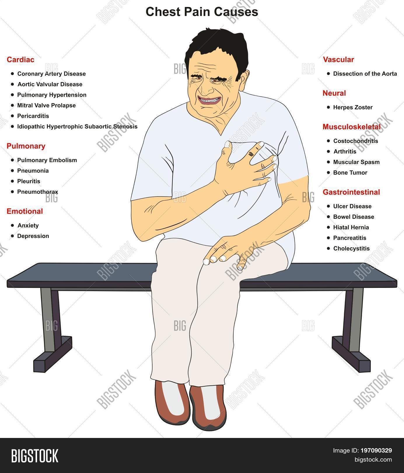 Chest Pain Common Image & Photo (Free Trial) Bigstock