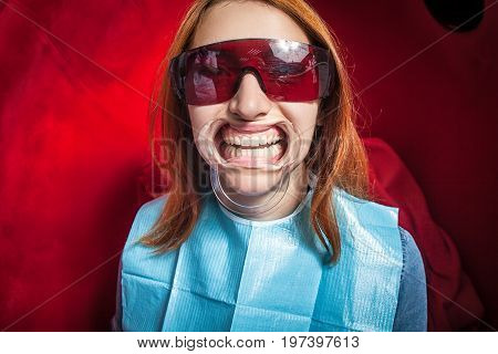 Woman  With Tooth-holder Whitening Teeth