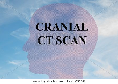 Cranial Ct Scan - Medical Concept