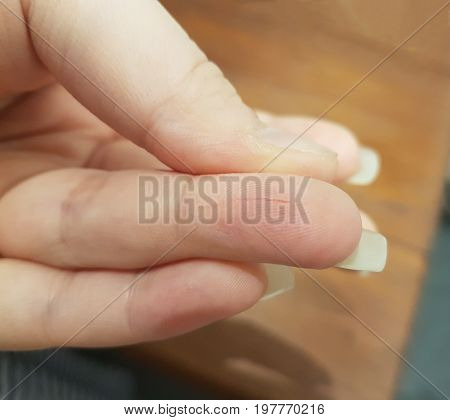 Foreground close up image of a cut on a girl's finger with blur background