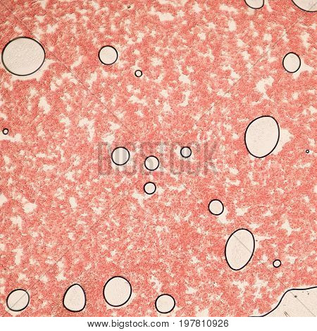 Blood Smear Under Microscope Present Neutrophils And Red Blood Cells. Photo Micro Sections With High