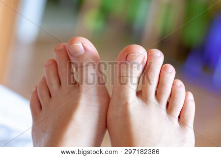 Young Girls Toes Are Healthy And Beautiful. Well-groomed Toes. Concept For Medical Articles And Oint