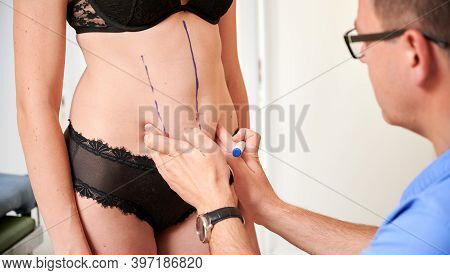 Close Up Of Female Patient In Black Lingerie Having Preoperative Marking Procedure Before Plastic Su