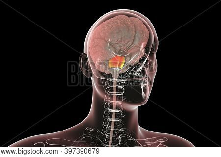 Pons Varolii Highlighted Inside Human Brain, 3d Illustration. It Part Of The Brainstem, Includes Neu
