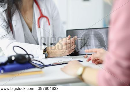 Doctor Shows The Patient An X-ray Of Lungs. Lung Disease Symptoms Concept