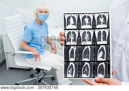 Pulmonologist Showing Ct Scan Of Lungs Elderly Patient With Pneumonia. Complication After Coronaviru