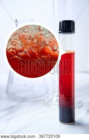 Medical Test Tube With Blood Sample For Laboratory Medical Testing And Magnification