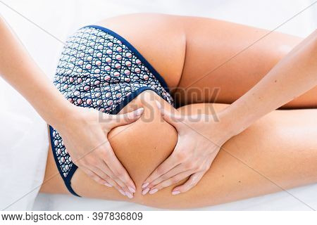 Legs And Buttocks Massage To Reduce Cellulite And Phlebeurysm And Preserve An Healthy Look. Skin And