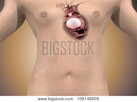 artificial heart