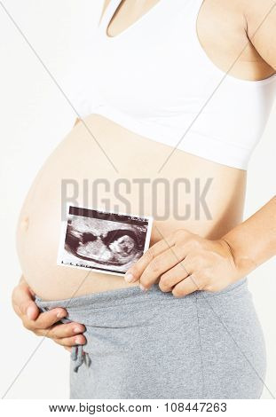 Pregnant Woman Holding The Digital Echography Photograph Of Her Baby In Front Of Her Belly, Soft Foc