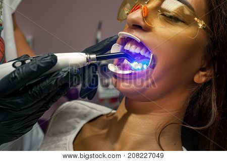 Dentist in gloves treats teeth of young woman using photopolymer lamp and mouth dilator. Close up.