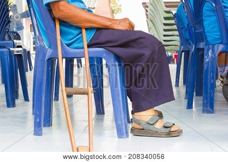 closeup a man suffering from leprosy with wooden crutch