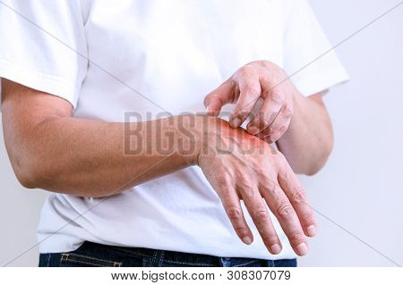 Woman Scratching An Itch . Sensitive Skin, Food Allergy Symptoms, Irritation
