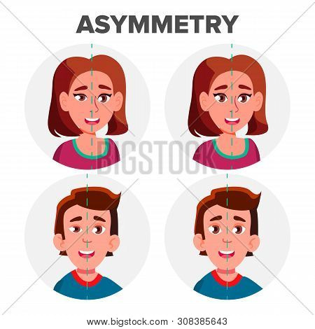 Eyes Asymmetry Of Character Man And Girl . Young Boy Male And Woman Female Ptosis Eyelid Asymmetry. 