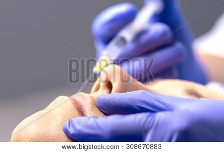 Close Up Of Lip Augmentation With Injection Needle In Beauty Salon Or Plastic Surgery Clinic By Doct