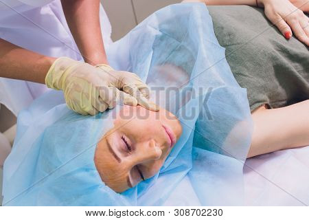 Aged Woman Doing Mesothreads And Thread Lifting, Cosmetology. Cosmetic Procedure To Eliminate Signs 