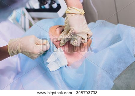 Aged Woman Doing Mesothreads And Thread Lifting, Cosmetology. Cosmetic Procedure To Eliminate Signs 