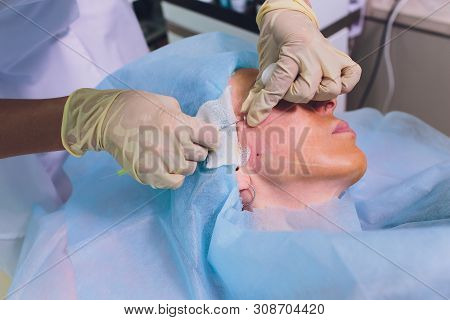 Aged Woman Doing Mesothreads And Thread Lifting, Cosmetology. Cosmetic Procedure To Eliminate Signs 