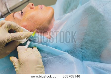 Aged Woman Doing Mesothreads And Thread Lifting, Cosmetology. Cosmetic Procedure To Eliminate Signs 