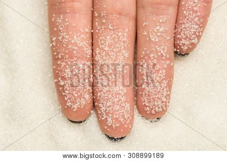 Women's Fingers On Which Stuck Grains Of Sugar Close-up