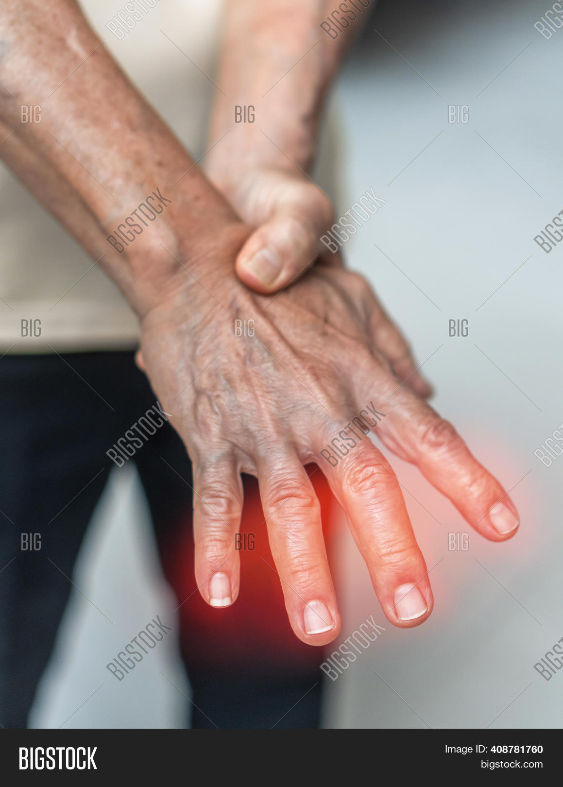 Peripheral Neuropathy Image & Photo (Free Trial) Bigstock