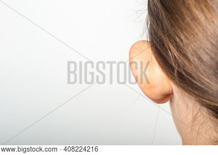 Female Ear, Lop-eared, Protruding, Close-up On A Light Background. Auricle Defect.
