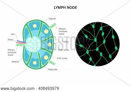 Anatomy Of A Lymph Node Illustration For Clinic, Hospital Or Medical Poster. Human Lymphatic System 