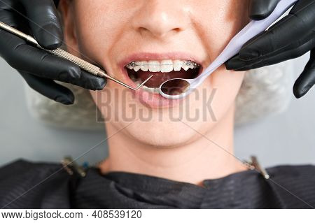 Top View On Girls Mouth In Dentist Chair. Cropped Dentists Hands, In Black Rubber Gloves, Checking U