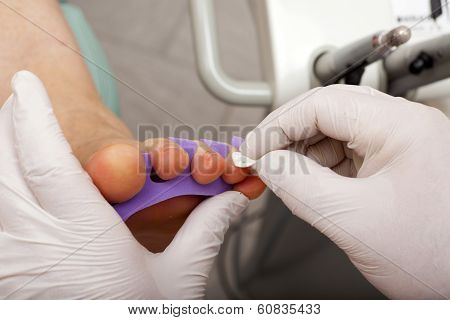 Chiropodists Cleans The Toenails