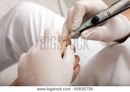Edit Toenail With Grinding Machine