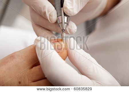 Chiropodist Polishing