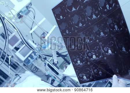 Medical Doctor Considering Ct Scan Of Heavy Patient In Hospital;