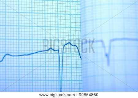 Seismograph Draw On The Grid Paper