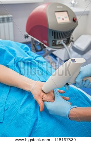 Procedure against hyperhidrosis