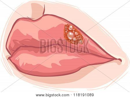 White Background Vector Illustration Of A Lip Herpes