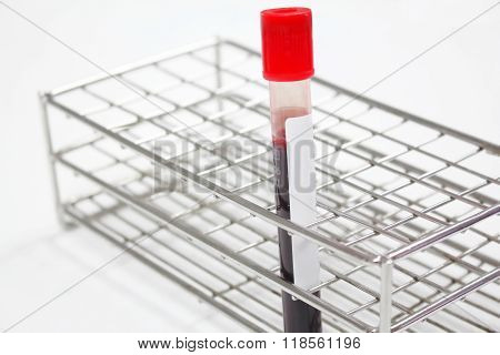 Blood sample in a test tube Vacutainer