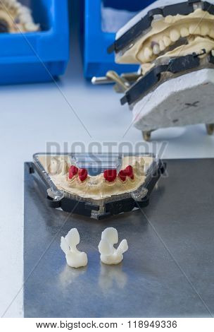 Dental Model And Two Tooth Made In Lithium Disilicate.