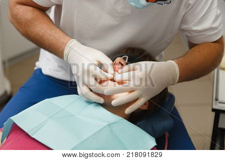 Process Of Preparing And Installing Dental Ceramic Crown. Male Professional Dentist And Female Assis