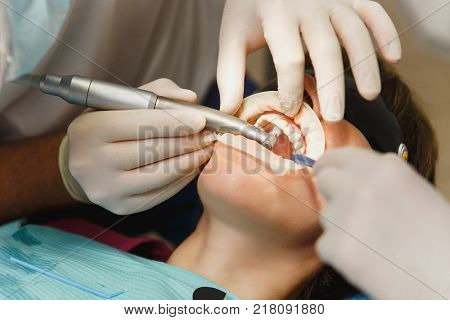 Process Of Preparing And Installing Dental Ceramic Crown. Male Professional Dentist And Female Assis