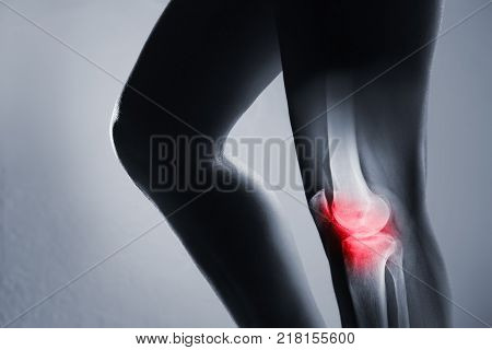 Human Knee Joint And Leg In X-ray