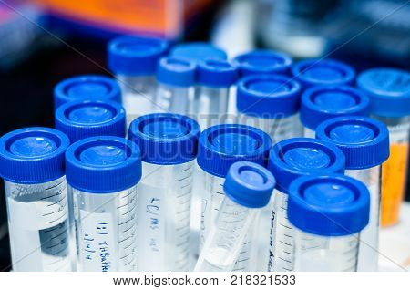 A set of blue cap 50 mL and 15 mL centrifuge tubes with samples and buffers on a biology and chemistry laboratory bench.