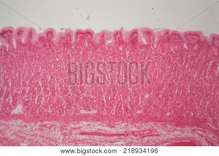 Section Of The Cardiac Region Of A Dog Stomach