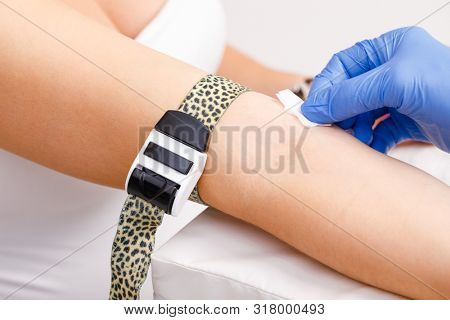Close-up shot of doctor or nurse disinfecting skin preparing to take a blood sample from arm vein during venipuncture or venepuncture procedure
